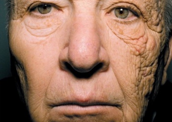 Stokoderm UV30 защита от фотостарения кожи