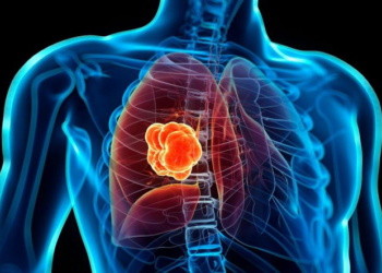 Как бороться с возникновением онкологии у сварщиков